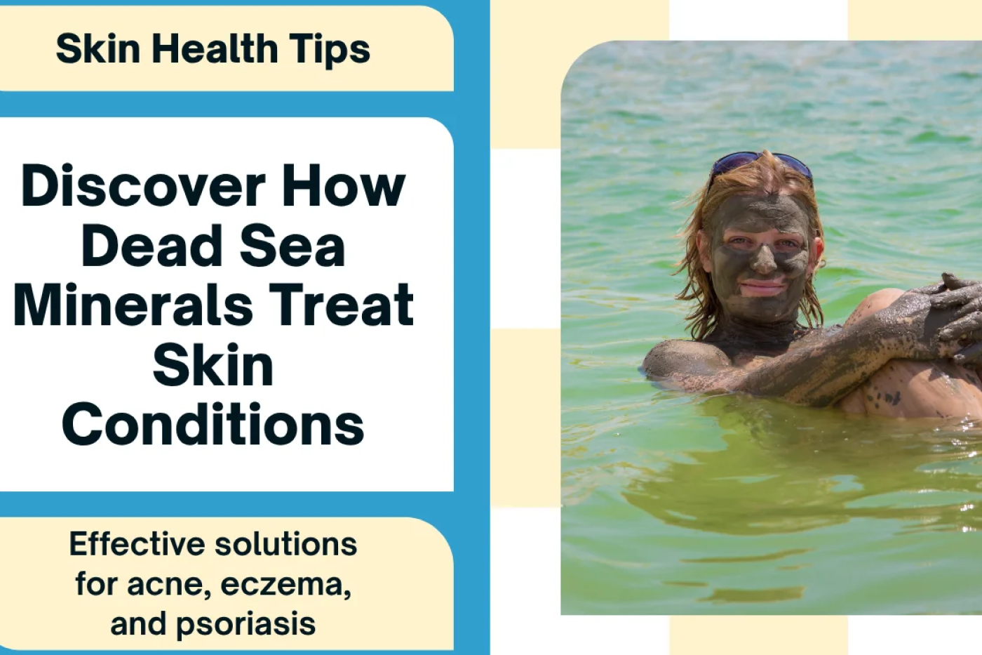 How Dead Sea Minerals Help Treat Acne, Eczema & Psoriasis